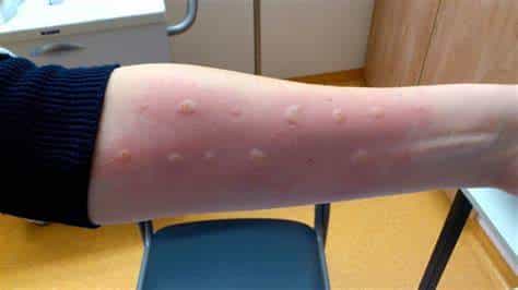 The Truth About Cat Allergies: Myths, Facts, and Solutions