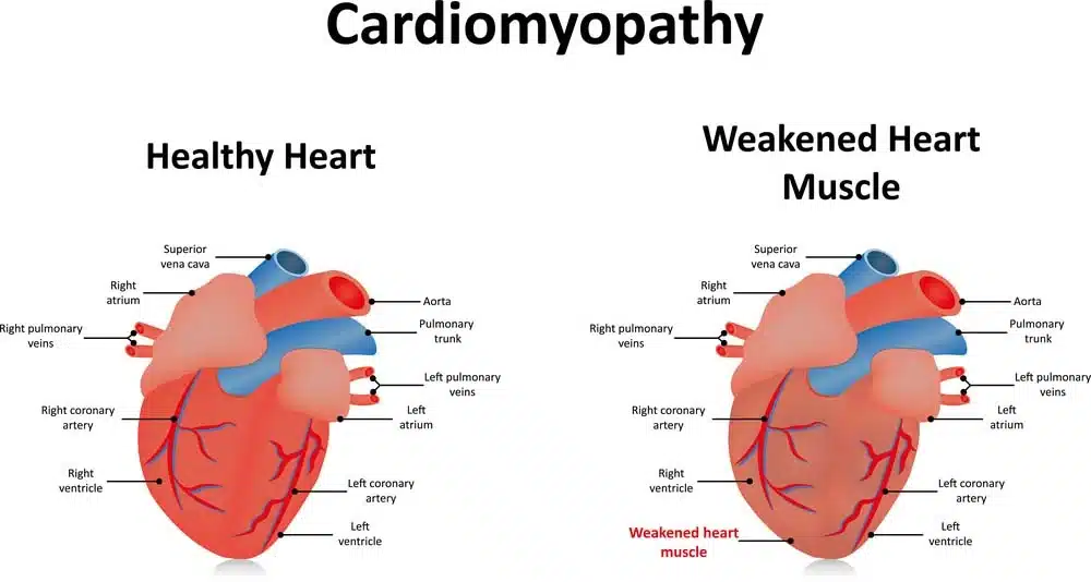 The Truth About Grain-Free Diets for Dogs